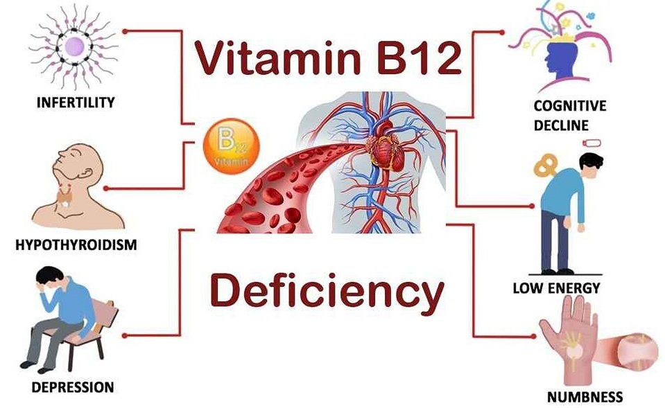 VEGANS-VEGETARIANS-DEFICIENCY OF VITAMIN B-12.