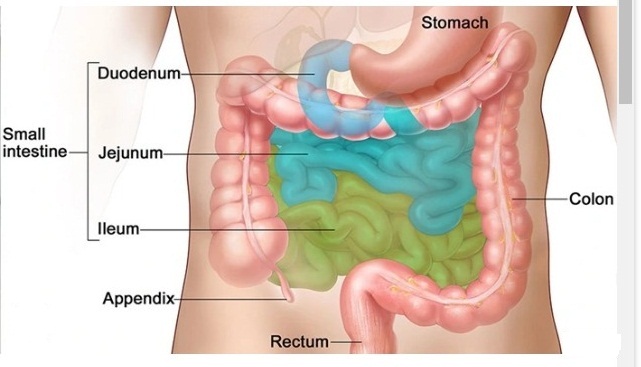 “UNDERSTANDING METABOLIC CONDITIONS LINKED TO DYSBIOSIS: CAUSES,SYMPTOMS AND TREATMENT.