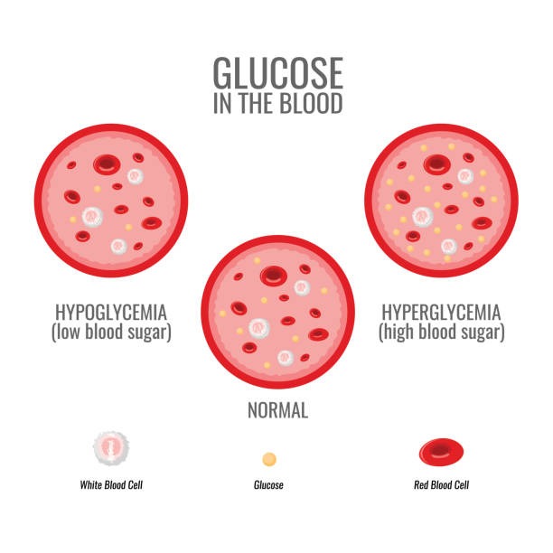 Understanding Reactive Hypoglycemia Causes And Effective Management Strategies Nutrition